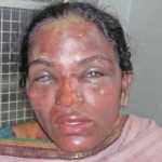 Acid-throw-the-widow-refused-to-marry-boyfriend-suicide-in